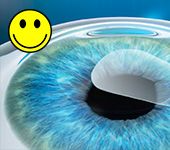 Femtosekundový laser VISUMAX 500